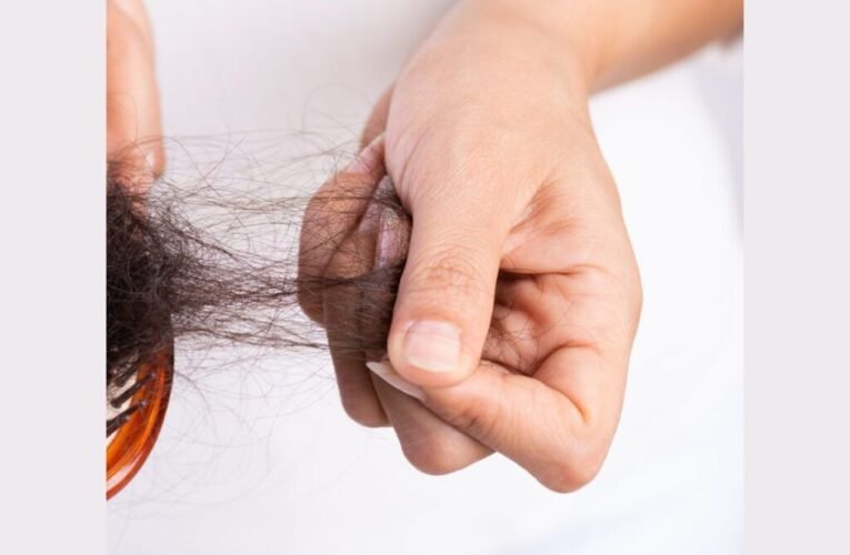 Causes of Hair Loss, Homeopathic Remedies for Hair fall