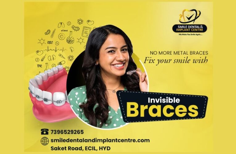 Smile Dental and Implant Centre shared the benefits of Invisible Braces over the Traditional Braces Treatment in a recently held Press Conference   