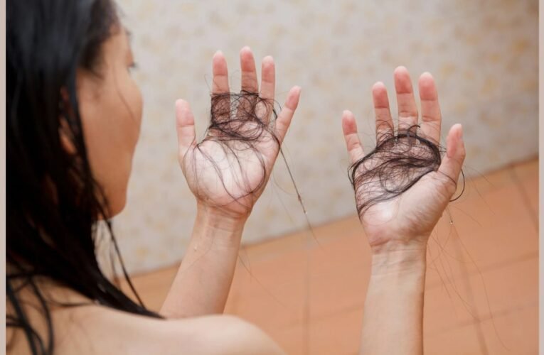 Hair gone, Regrown again – A homeopathic way to regain hair after Chemotherapy